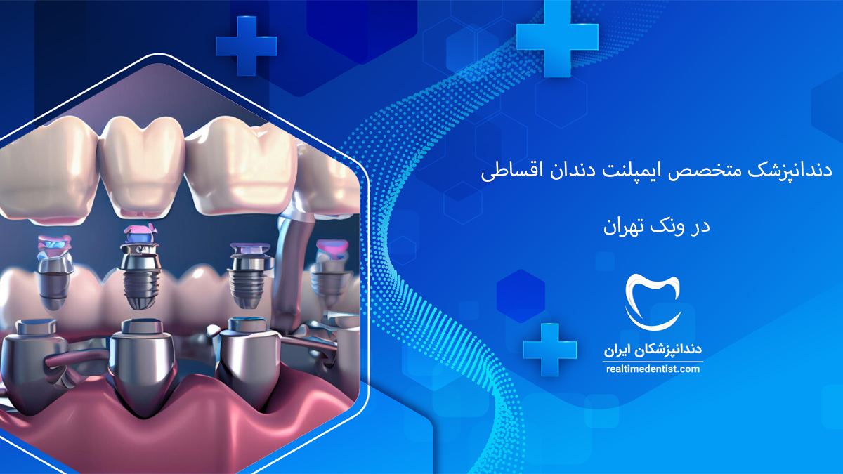 ایمپلنت دندان اقساطی در ملاصدرا تهران