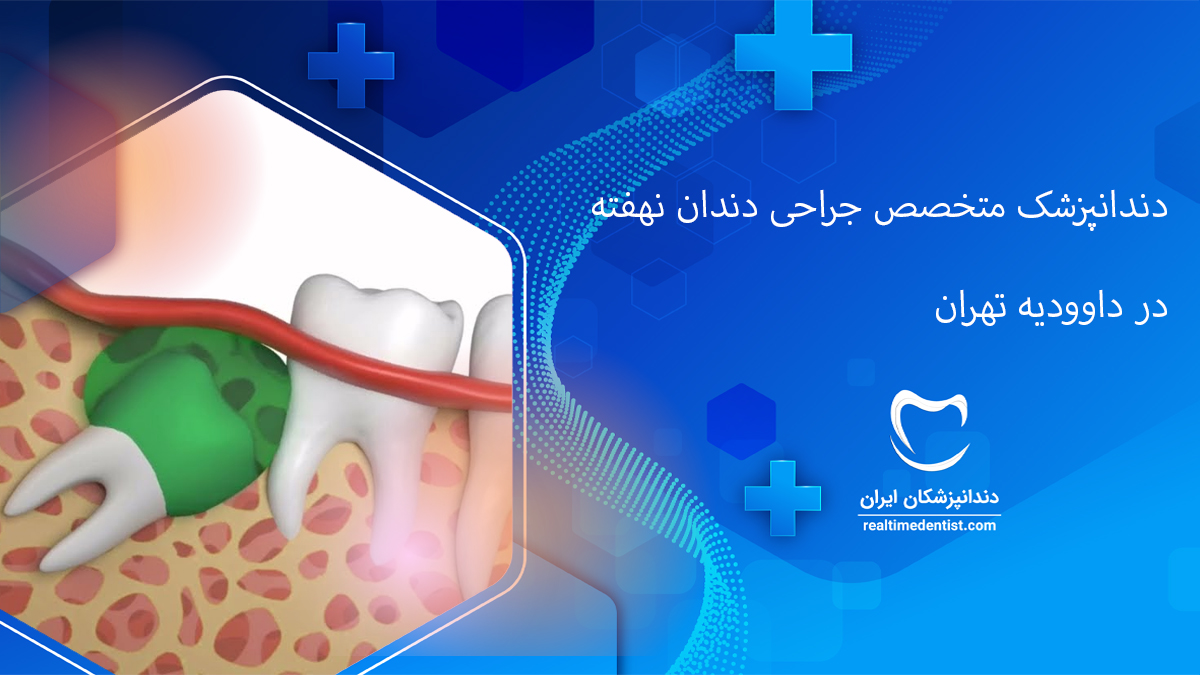 جراحی دندان نهفته در داوودیه تهران