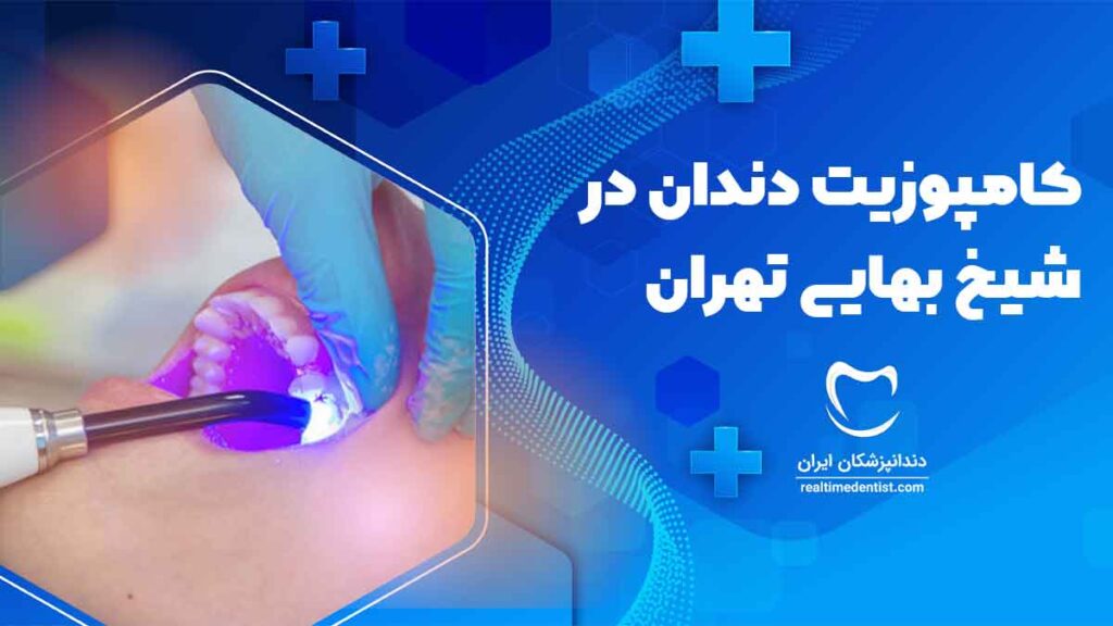 کامپوزیت دندان در شیخ بهایی تهران