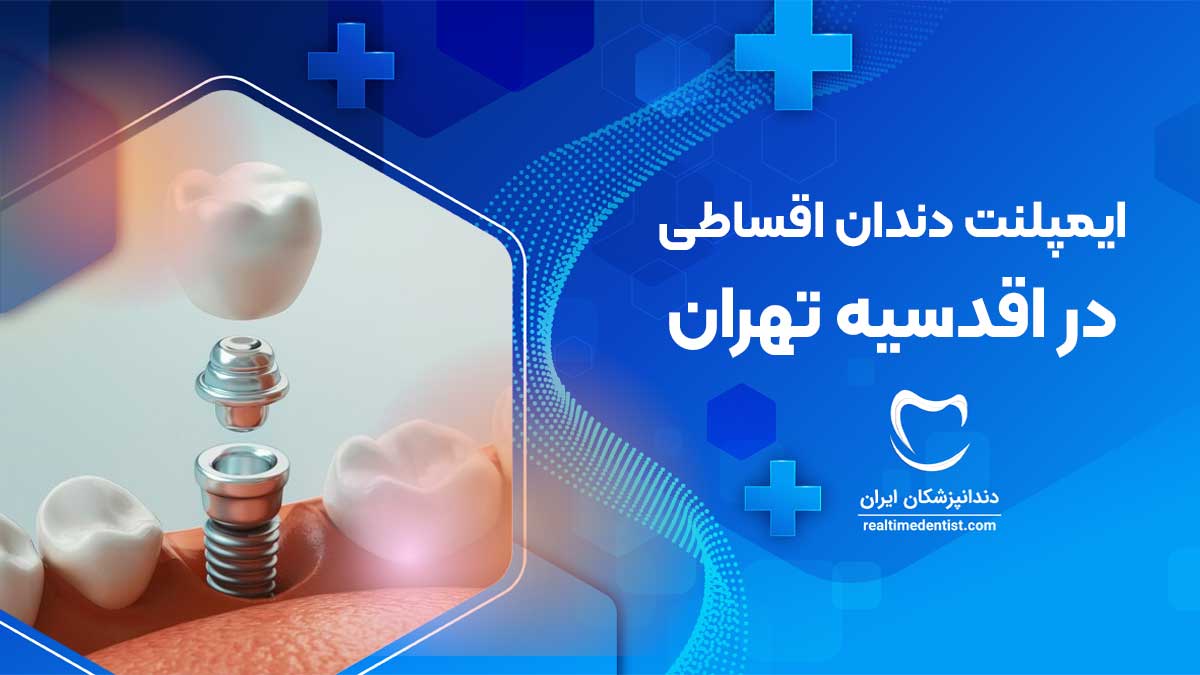 ایمپلنت دندان اقساطی در اقدسیه تهران