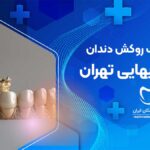 روکش دندان در شیخ بهایی تهران