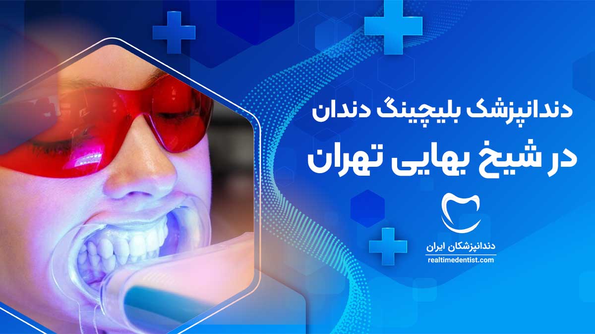 بلیچینگ دندان در شیخ بهایی تهران