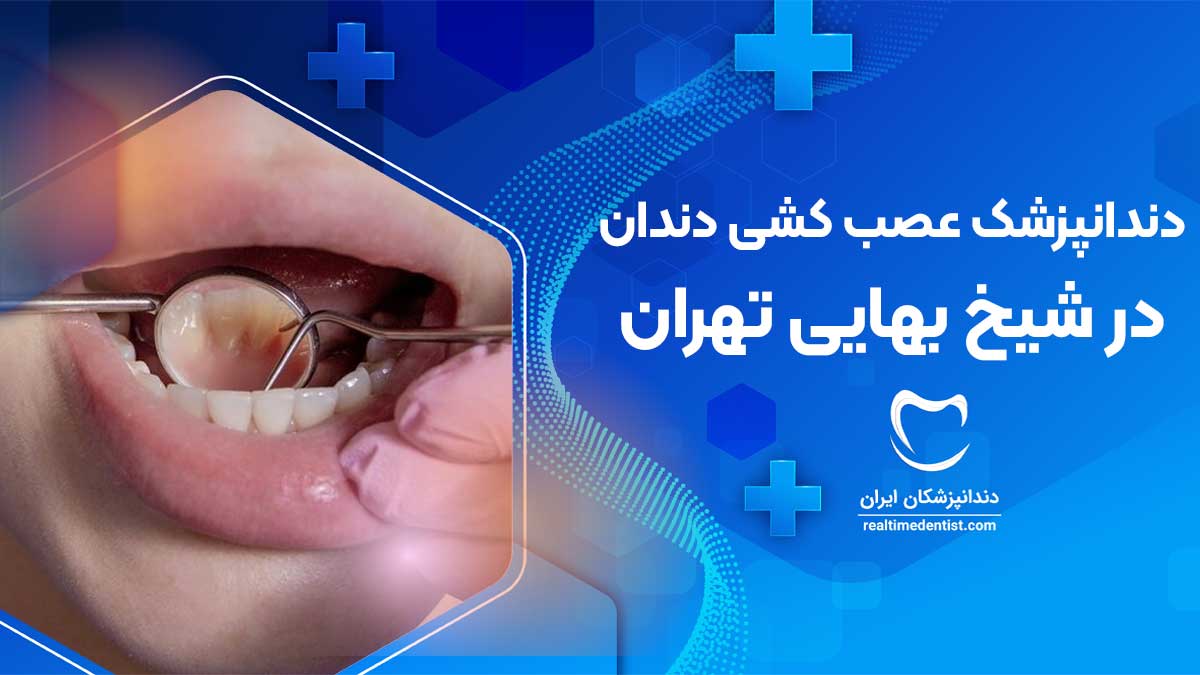 عصب کشی دندان در شیخ بهایی تهران