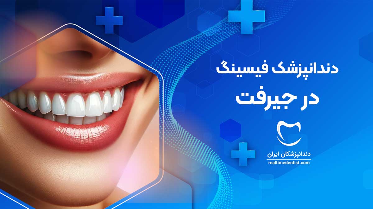 فیسینگ دندان در جیرفت