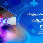 بلیچینگ دندان در جیرفت