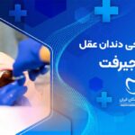 جراحی دندان عقل در جیرفت