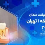 بهترین دکتر ایمپلنت دندان در منطقه 1 تهران