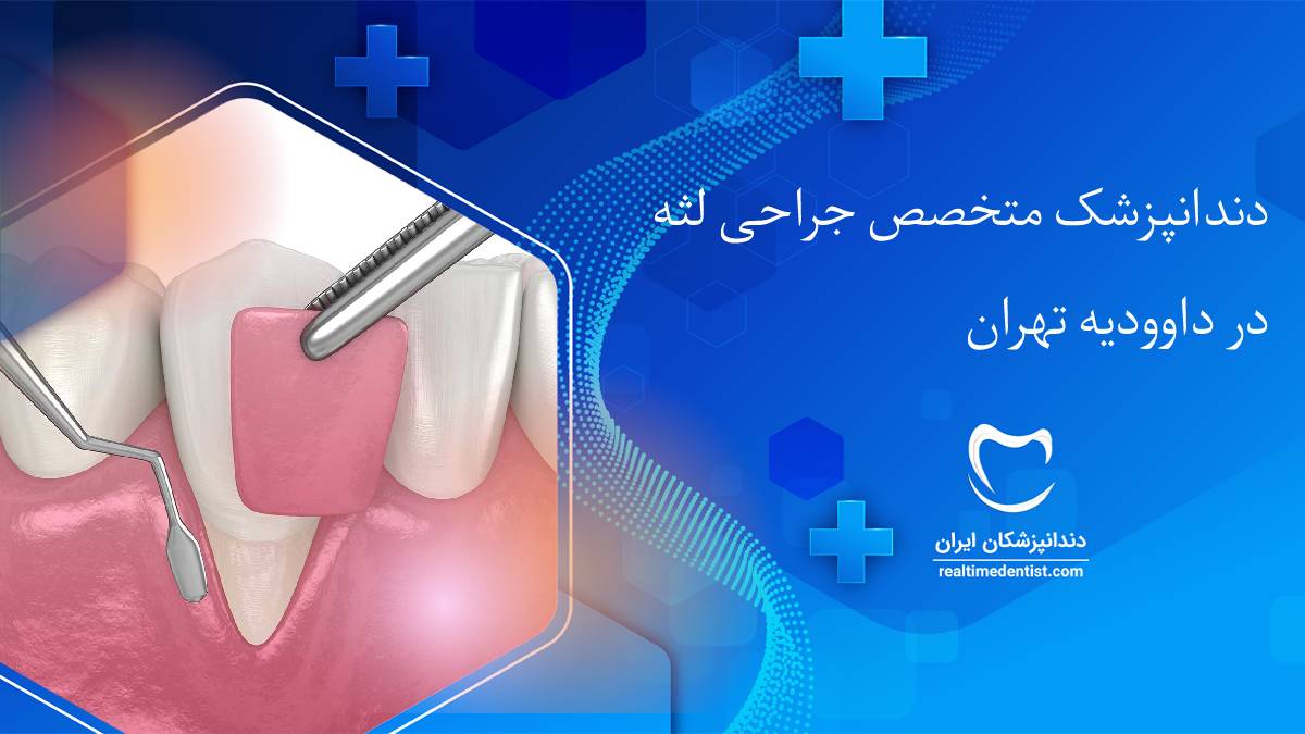 جراحی لثه در داوودیه تهران