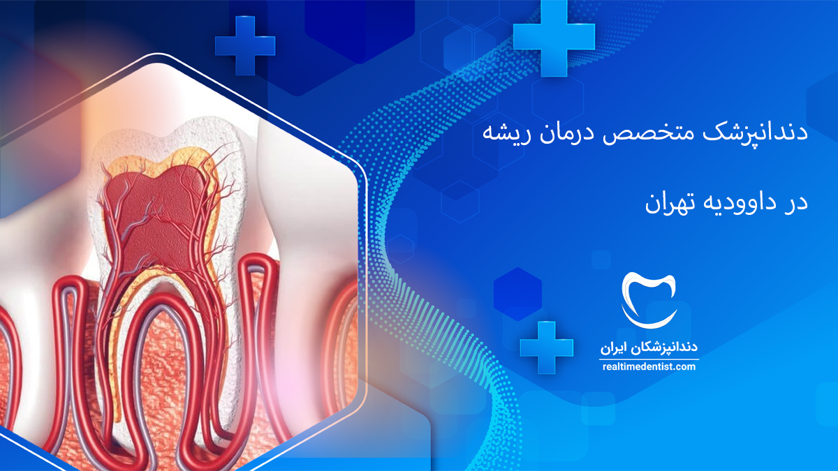 درمان ریشه دندان در داوودیه تهران