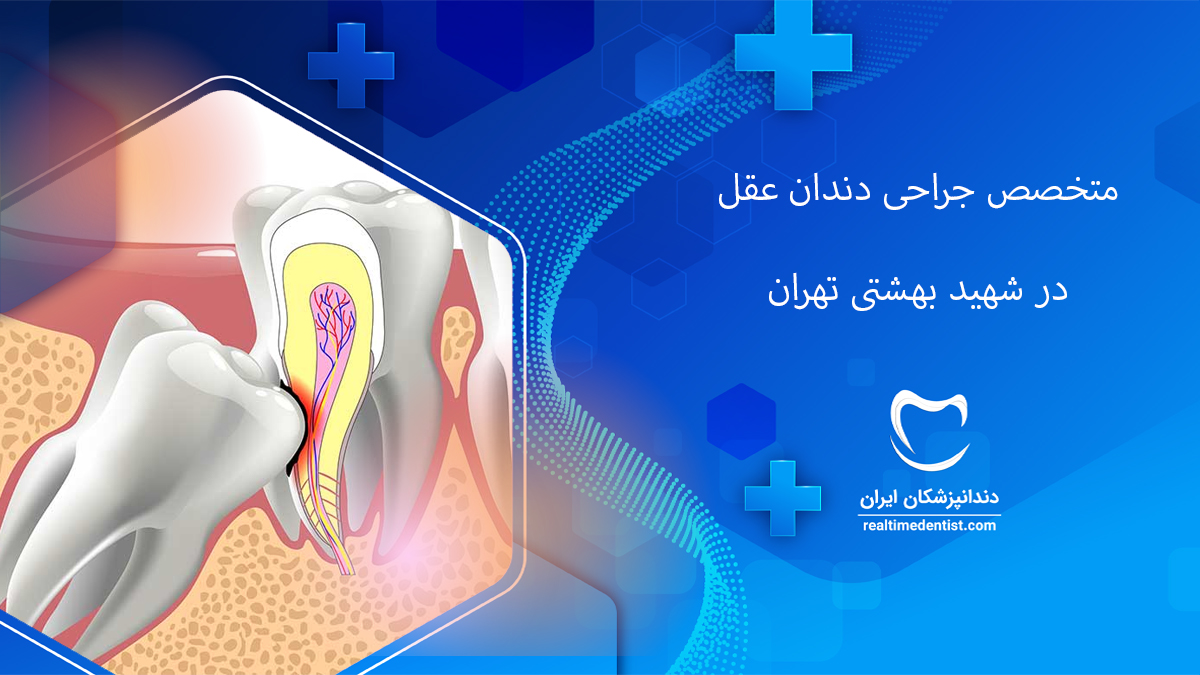 جراحی دندان عقل در شهید بهشتی تهران