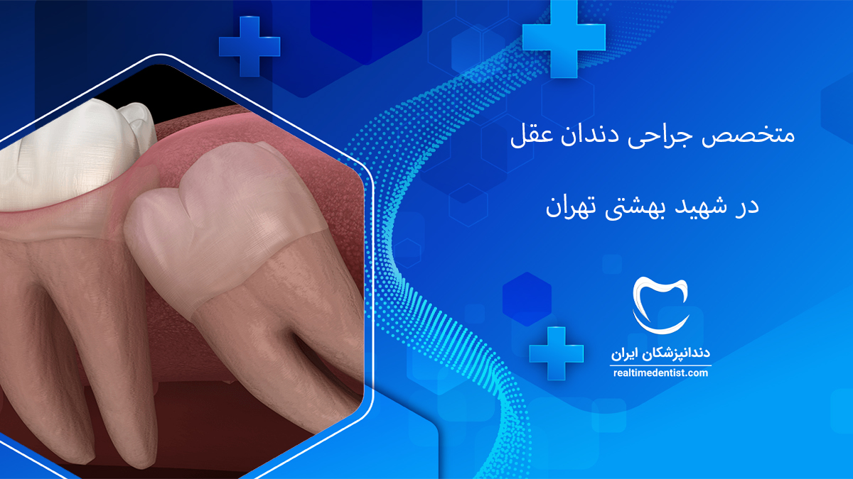 جراحی دندان عقل در شهید بهشتی تهران
