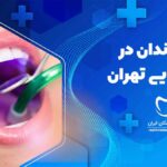 لمینت دندان در شیخ بهایی تهران