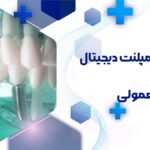 مقایسه ایمپلنت دیجیتال و ایمپلنت معمولی