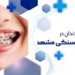 بهترین دندانپزشکی برای ارتودنسی در کوهسنگی مشهد