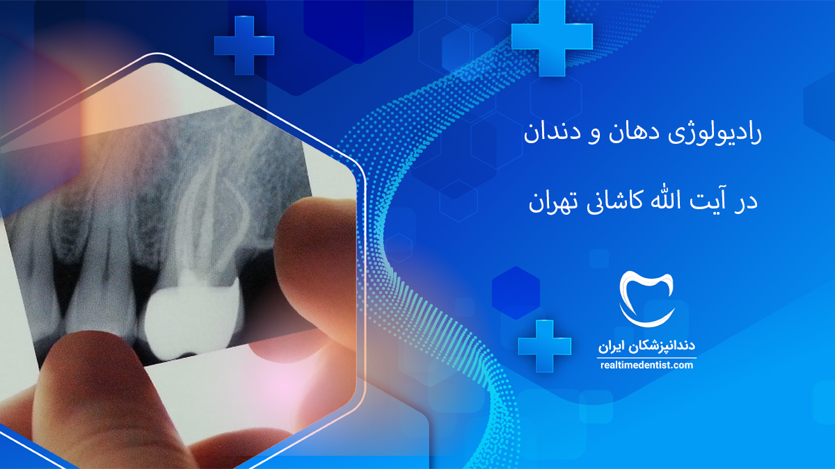 رادیولوژی دهان، فک و صورت در آیت الله کاشانی تهران