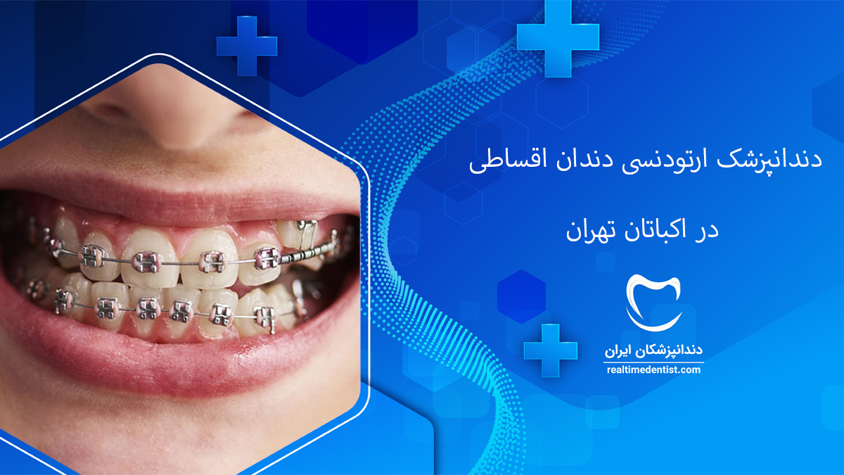 ارتودنسی دندان اقساطی در اکباتان تهران