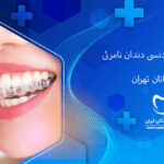 ارتودنسی دندان نامرئی در اکباتان تهران