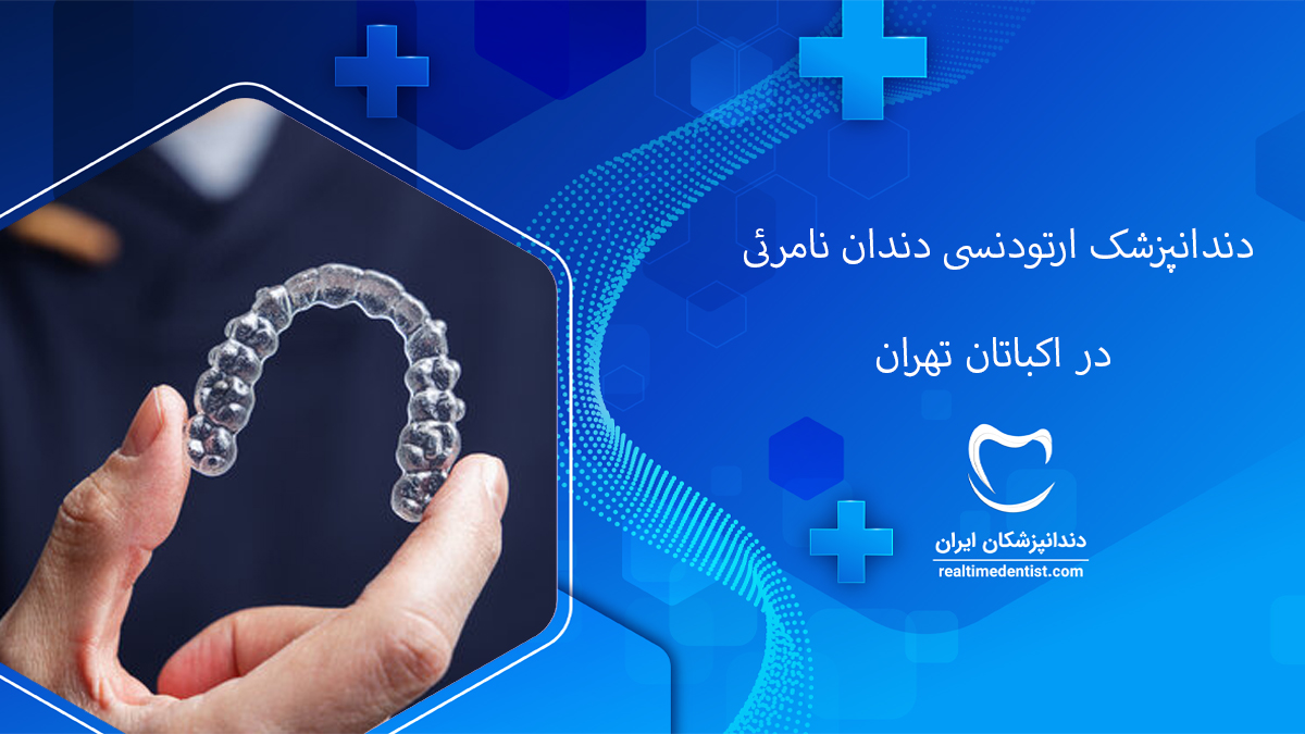 ارتودنسی دندان نامرئی در اکباتان تهران
