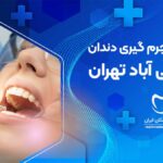 جرم گیری دندان در یاخچی آباد تهران