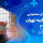 دندان مصنوعی در زعفرانیه تهران