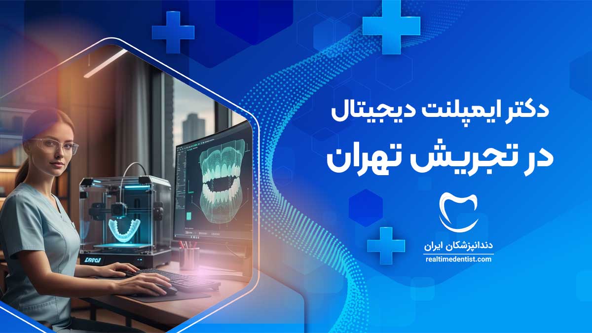 ایمپلنت دیجیتال در تجریش تهران