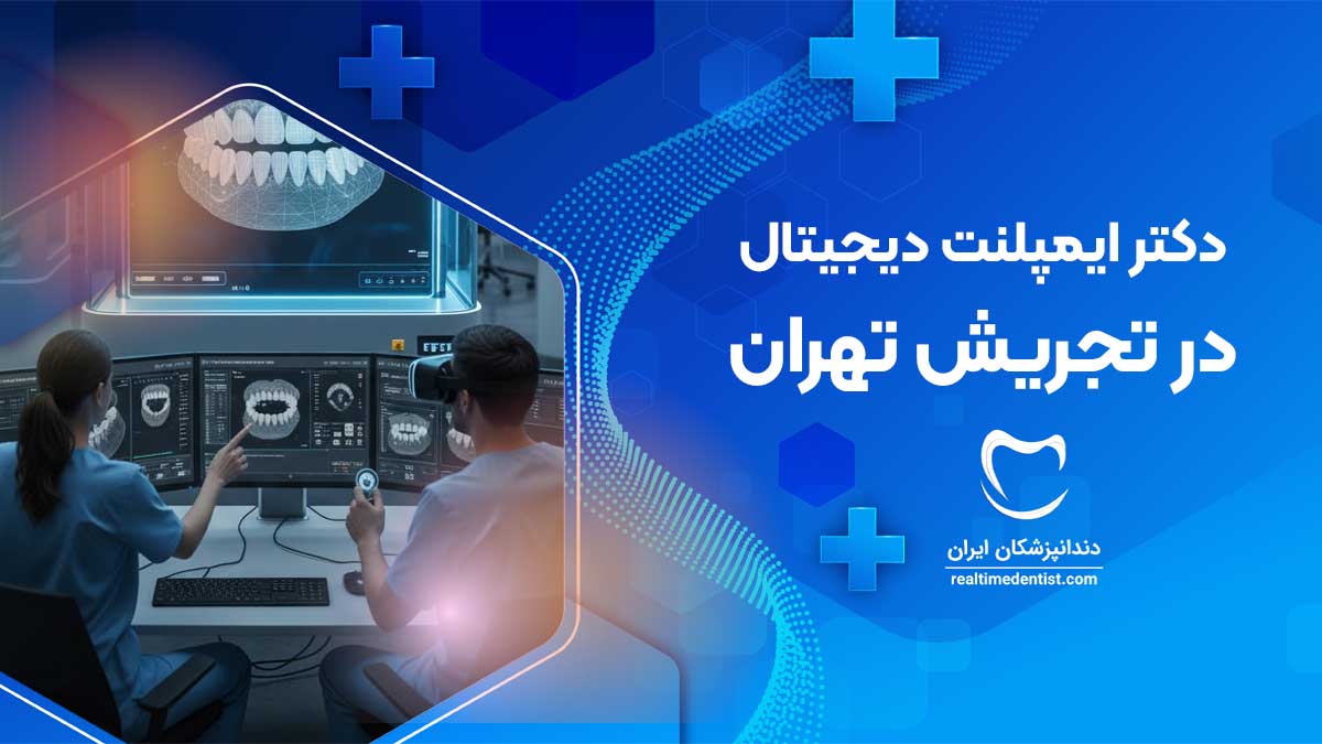 ایمپلنت دیجیتال در تجریش تهران