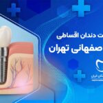 ایمپلنت اقساطی در اشرفی اصفهانی تهران