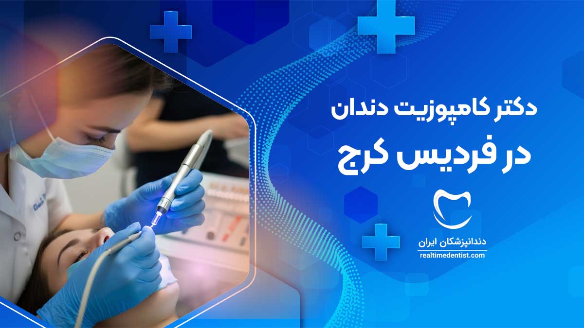 کامپوزیت دندان در فردیس کرج