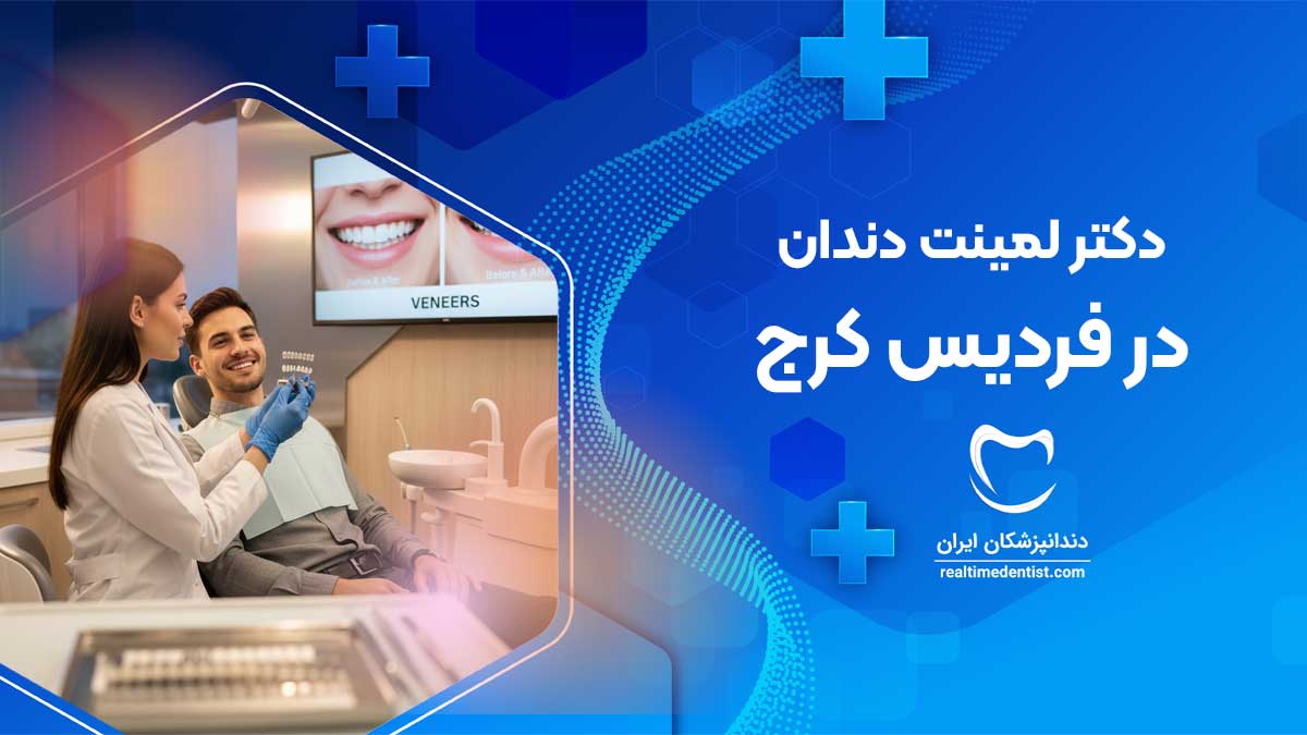 لمینت دندان در فردیس کرج