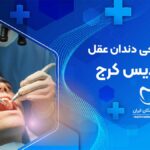 جراحی دندان عقل در فردیس کرج