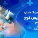 فیسینگ دندان در فردیس کرج
