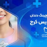 بلیچینگ دندان در فردیس کرج