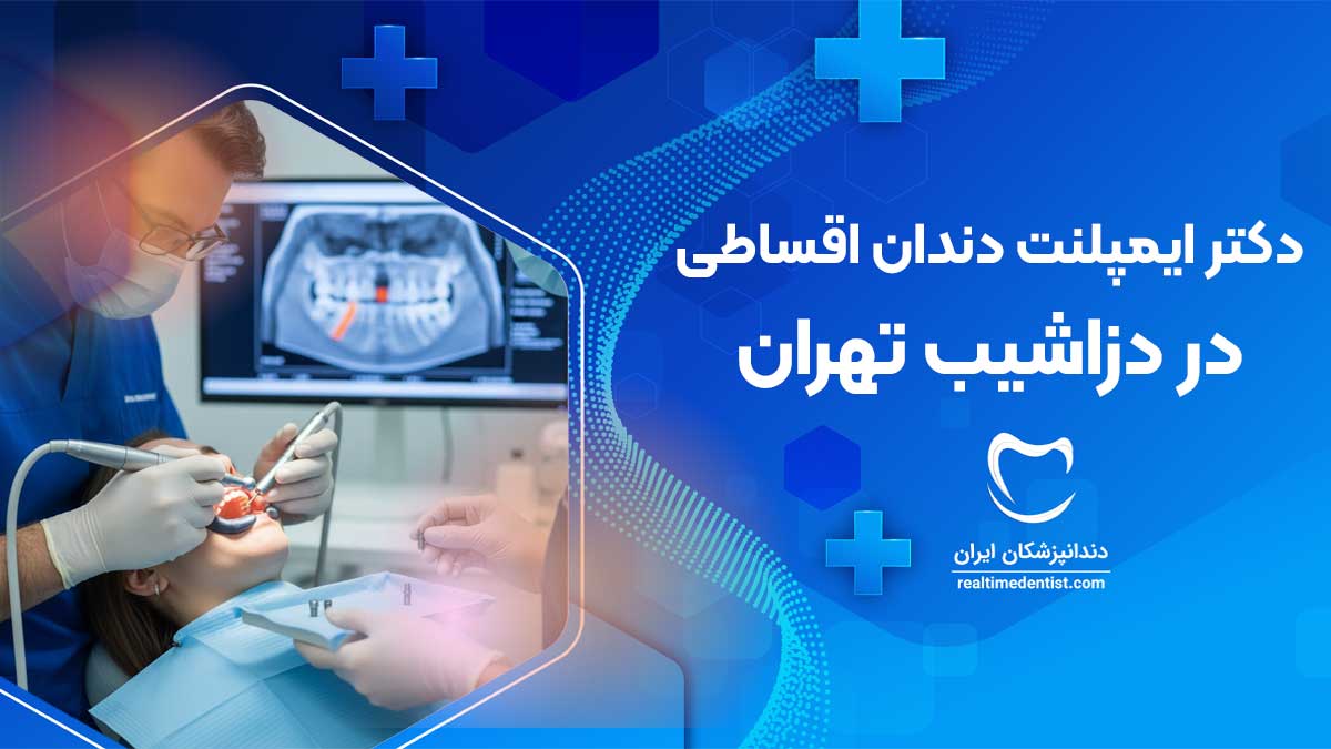 بهترین دکتر ایمپلنت دندان اقساطی در دزاشیب تهران