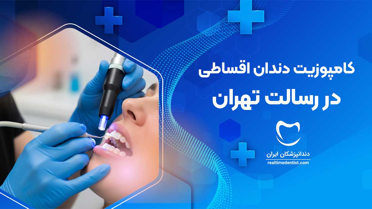 کامپوزیت دندان اقساطی در رسالت تهران