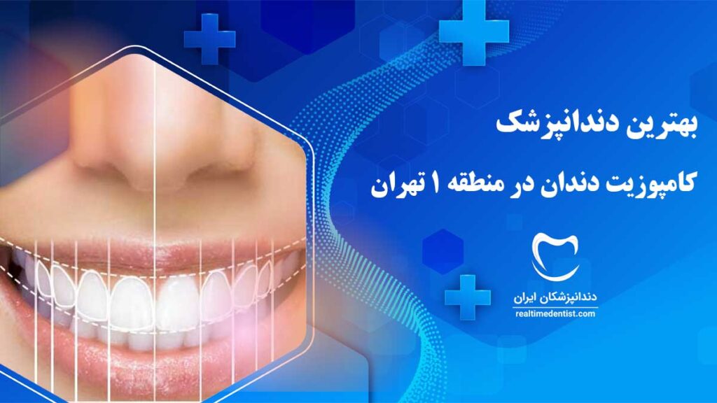 بهترین دکتر کامپوزیت دندان در منطقه 1 تهران
