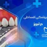 خدمات دندانپزشکی اقساطی در تبریز