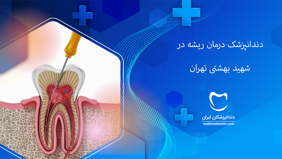 درمان ریشه دندان در شهید بهشتی تهران