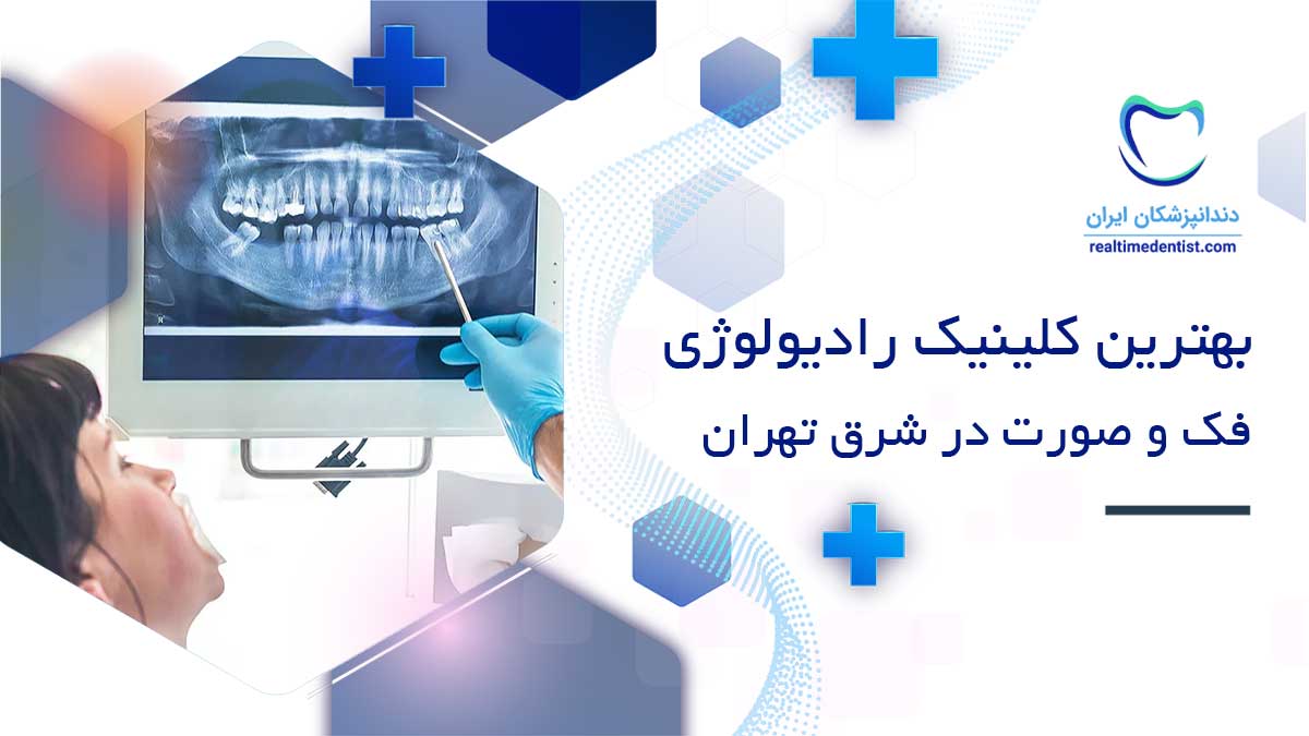 بهترین مراکز رادیولوژی فک و صورت در شرق تهران