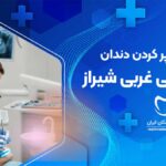 ترمیم و پر کردن دندان در قدوسی غربی شیراز
