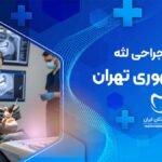 جراحی لثه در جمهوری تهران