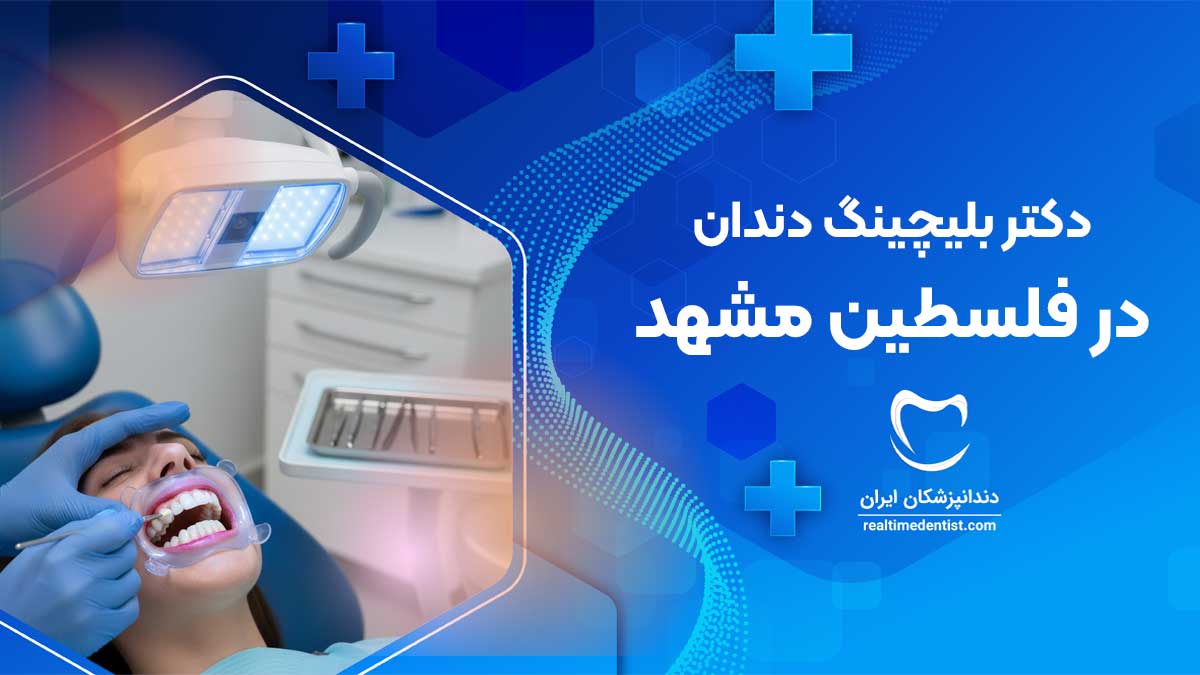 بهترین دکتر بلیچینگ دندان در فلسطین مشهد
