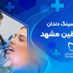 بهترین دندانپزشک فیسینگ دندان در خیابان فلسطین مشهد