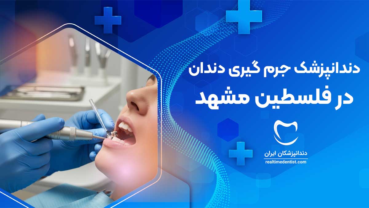 بهترین دندانپزشک جرم گیری دندان در فلسطین مشهد
