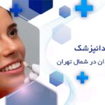 بهترین دندانپزشک فیسینگ دندان در شمال تهران