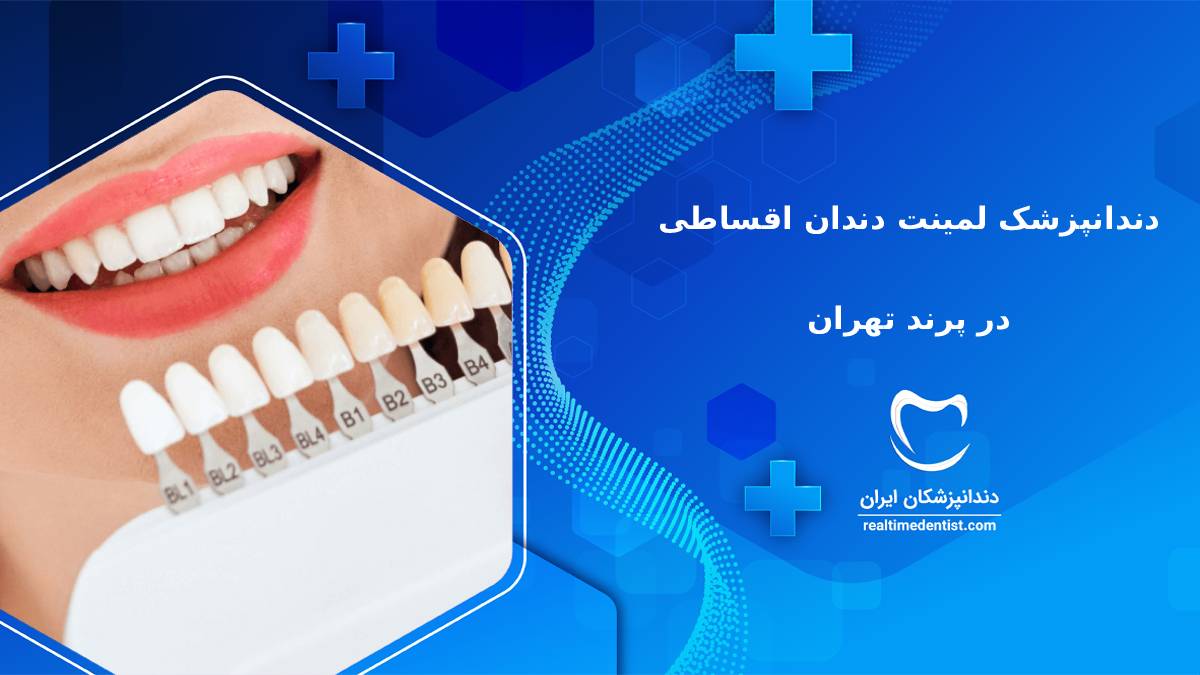 لمینت دندان اقساطی در پرند تهران