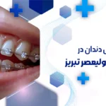 ارتودنسی در ولیعصر تبریز