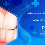 دندانپزشک فلوراید تراپی در سعادت آباد تهران