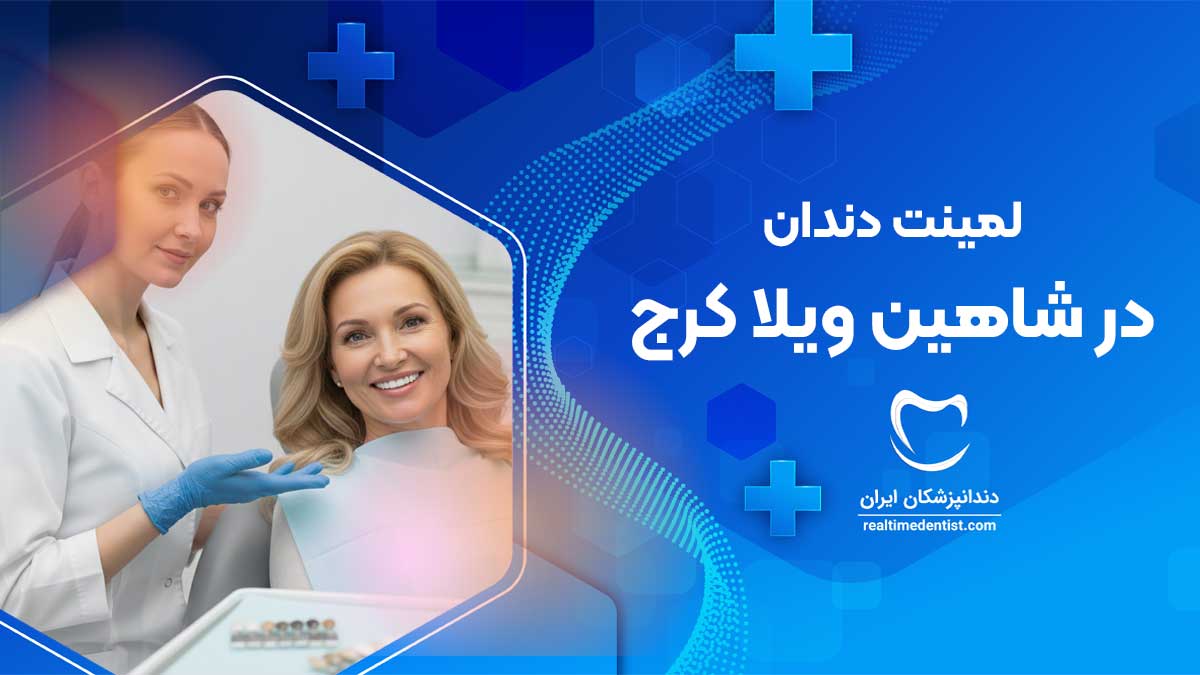 لمینت دندان در شاهین ویلا کرج