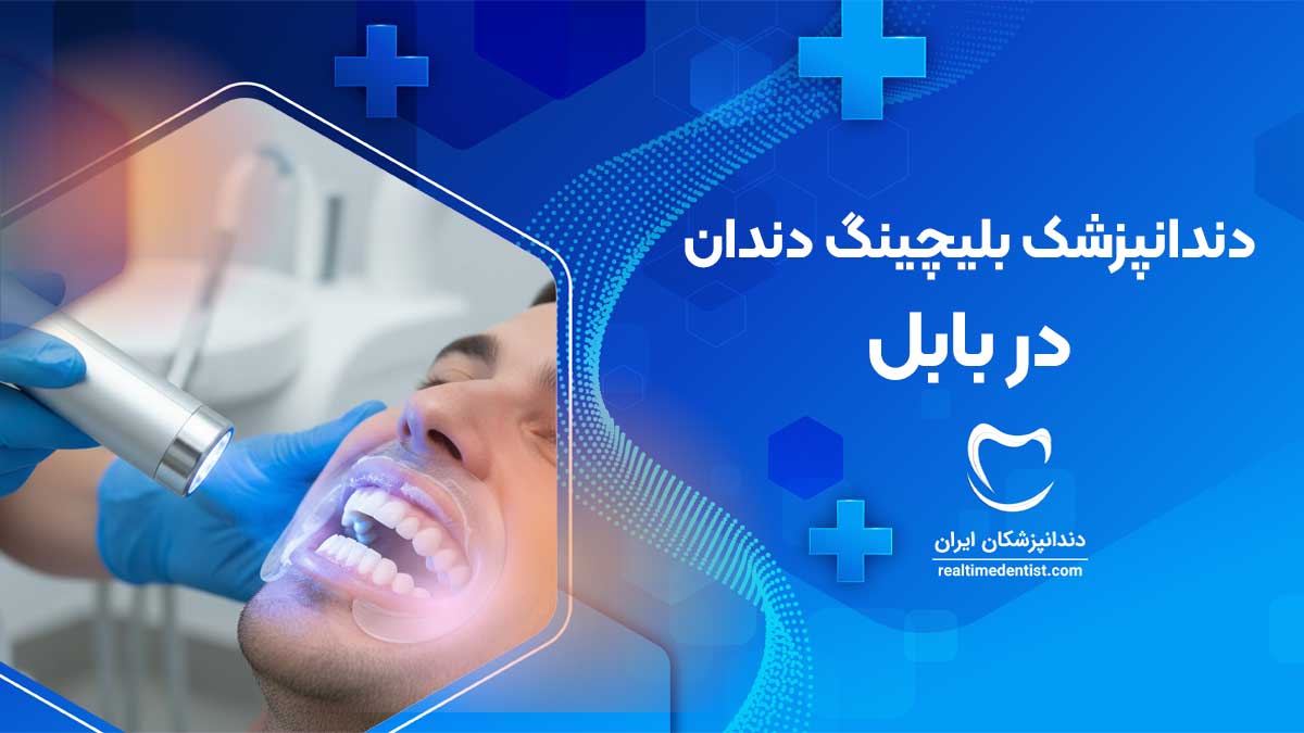 بلیچینگ دندان در بابل