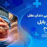 جراحی دندان عقل در بابل